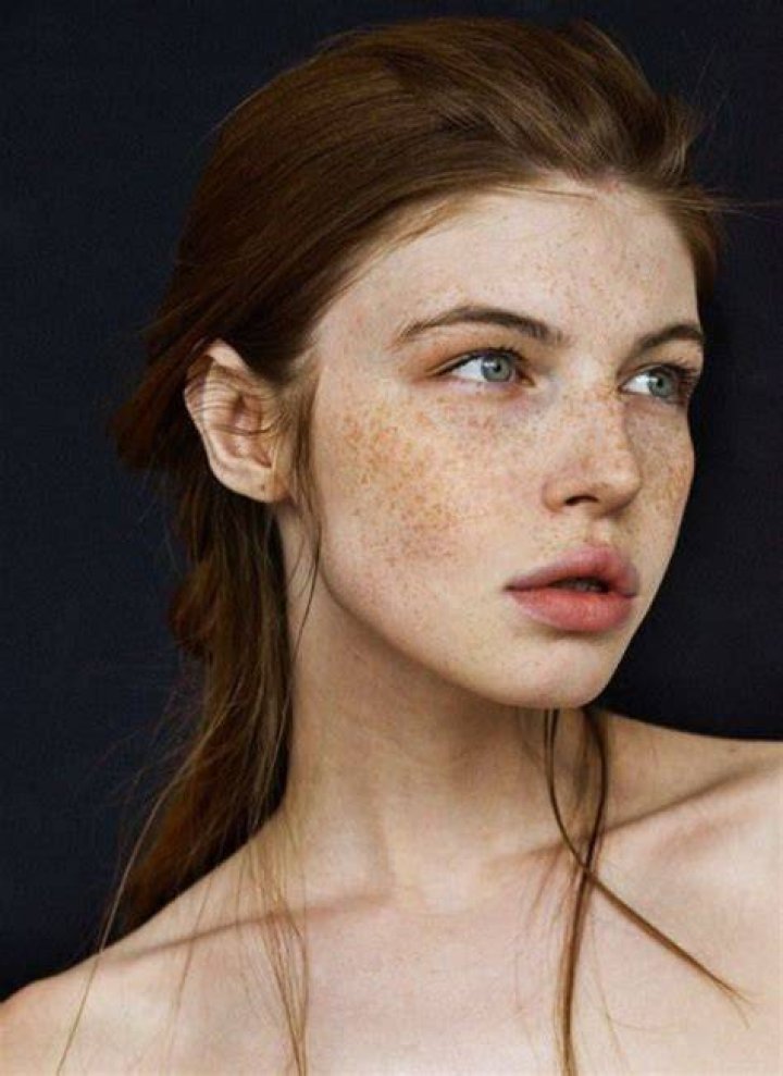 Are freckles cute?