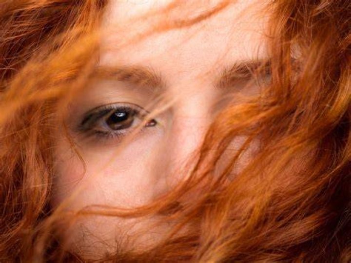 Are redheads more sensitive to pain?