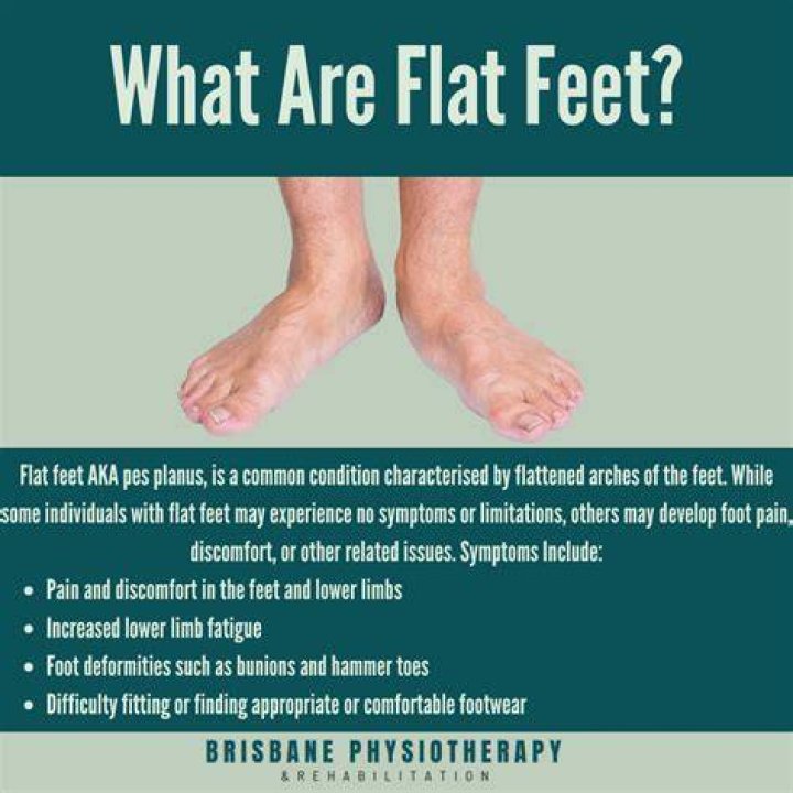Are there any perks to being flat footed?
