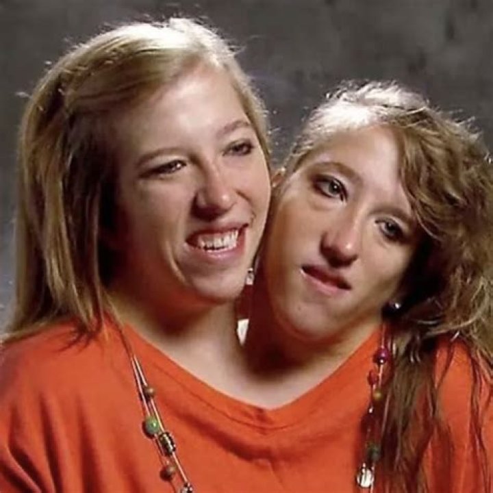 Are twins common or rare?