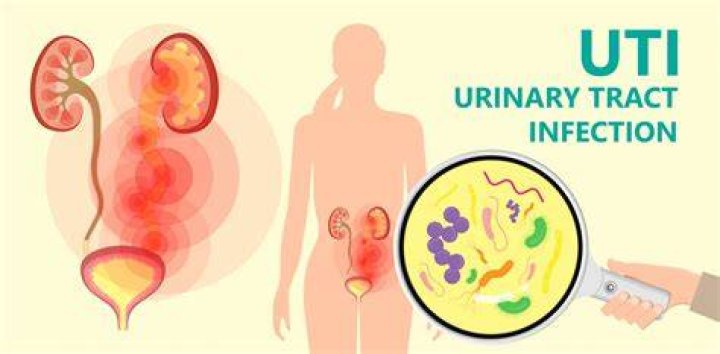 Can a bladder infection go away on its own?