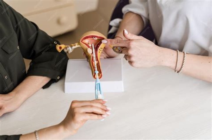 Can a guy finish in you with an IUD?