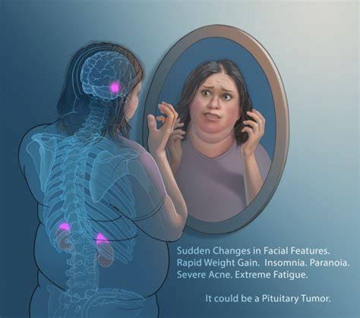 Can a pituitary tumor change your personality?