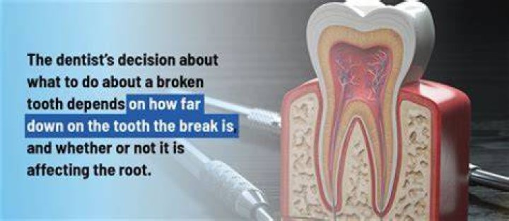 Can a punch break a tooth?