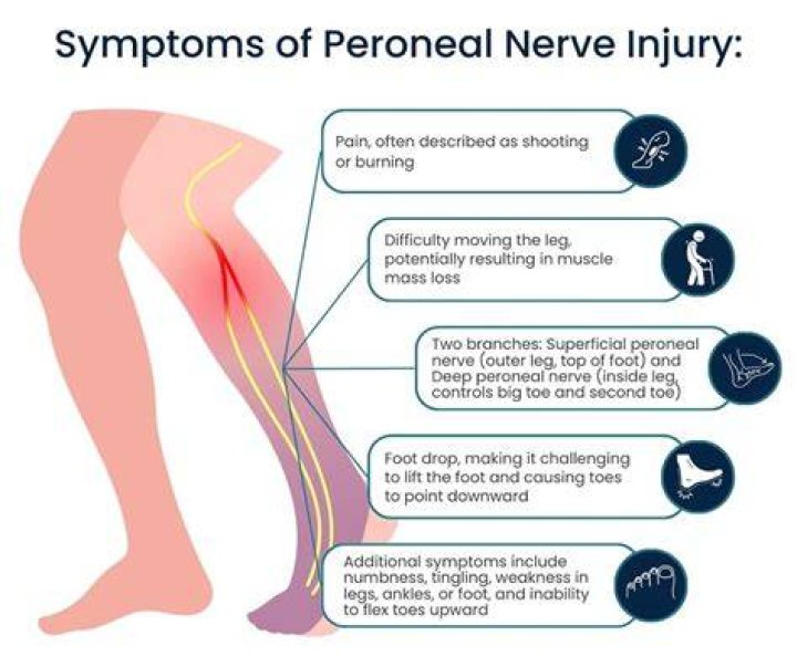 Can adrenal fatigue cause neuropathy?
