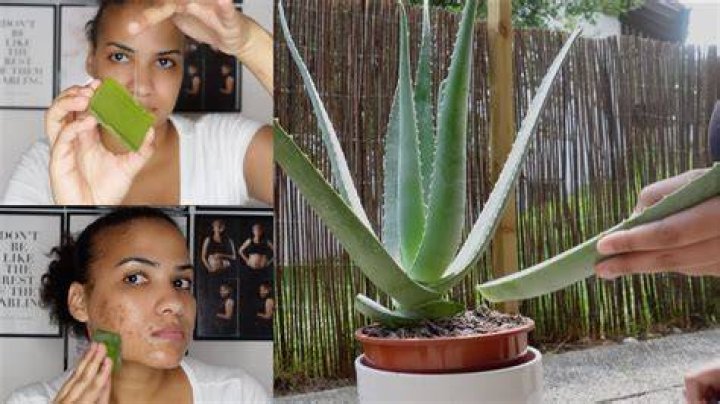 Can aloe vera remove white spots?