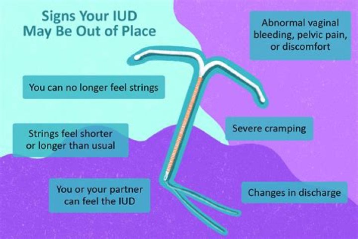 Can an IUD fail?