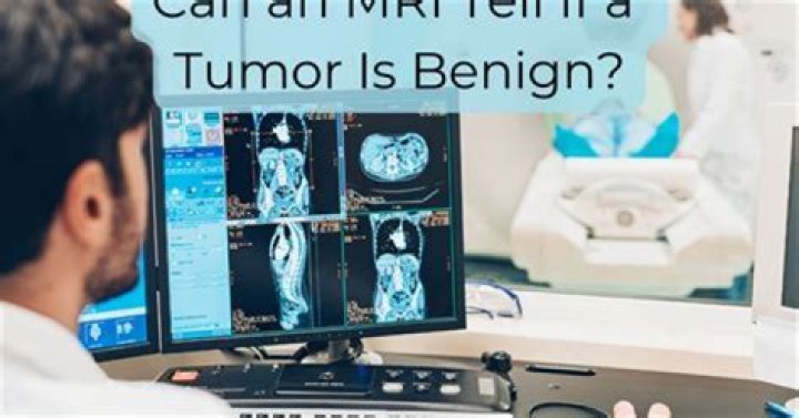 Can an MRI tell if a tumor is benign?