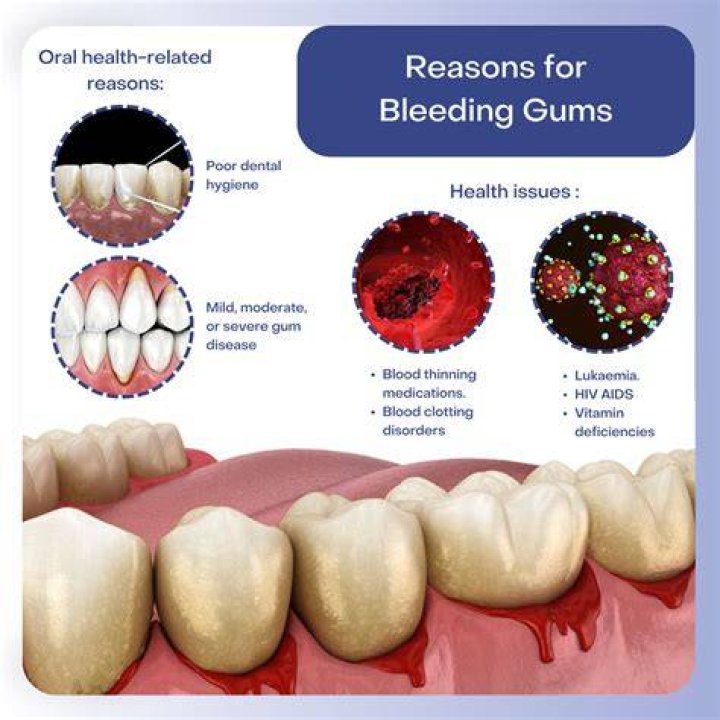 Can bleeding gums heal on its own?