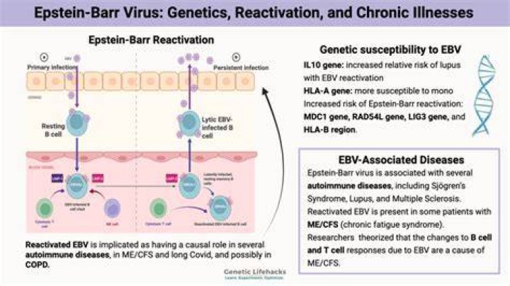 Can chronic Epstein-Barr be cured?
