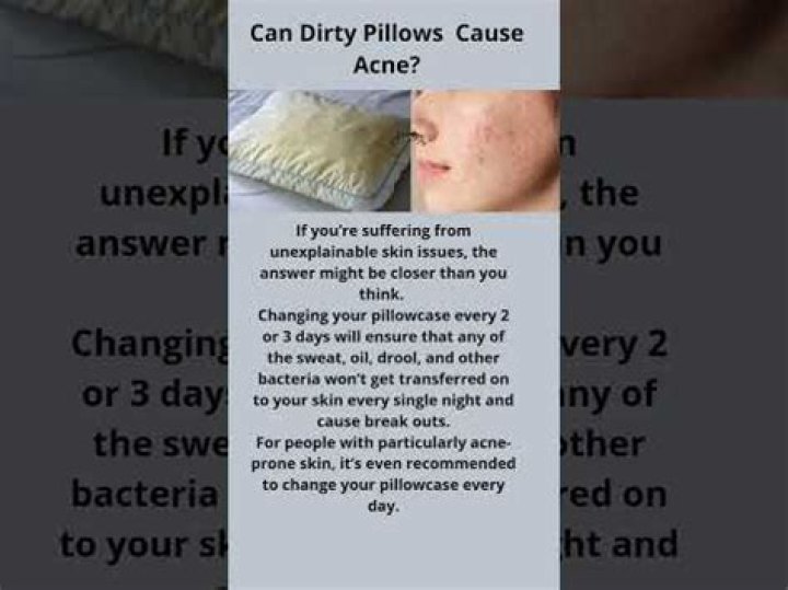 Can dirty pillows cause acne?