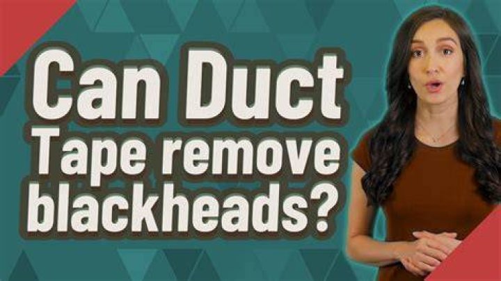 Can Duct Tape remove blackheads?