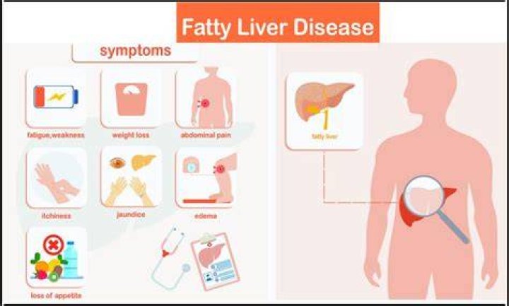 Can fatty liver disease cause sudden death?