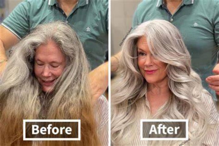 Can GREY hair be permanently removed?