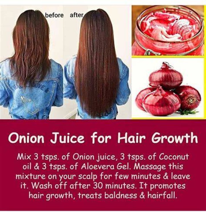 Can I directly apply onion juice on hair?