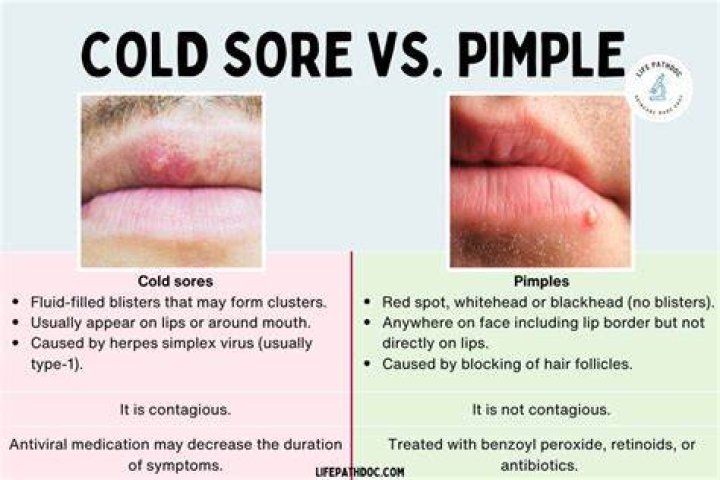 Can I get a pimple on my lip?