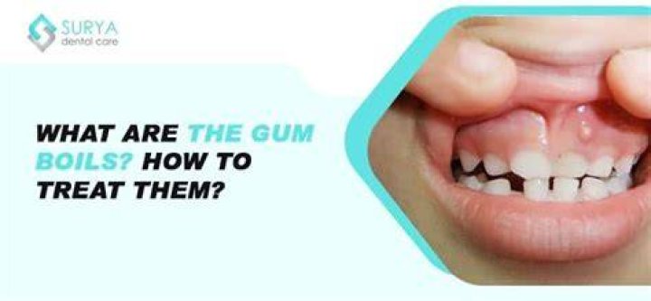 Can I pop a gum boil?