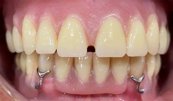 Can I see what I would look like with dentures?