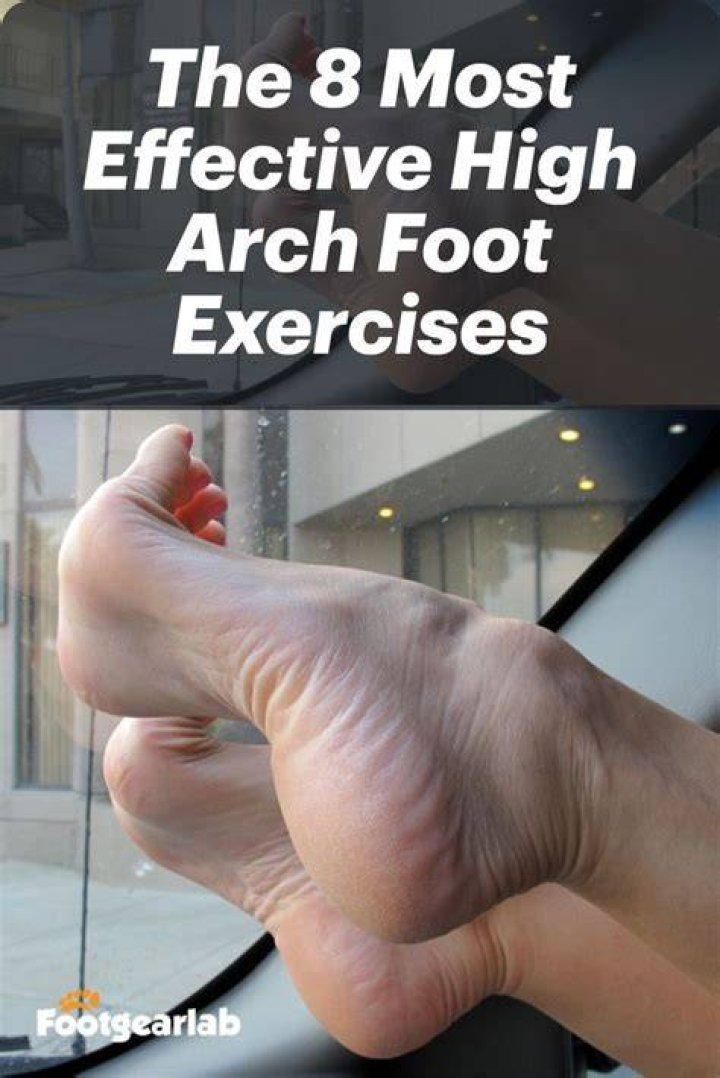 Can I strengthen my arches?