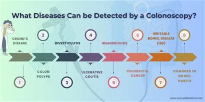 Can IBS be detected by a colonoscopy?