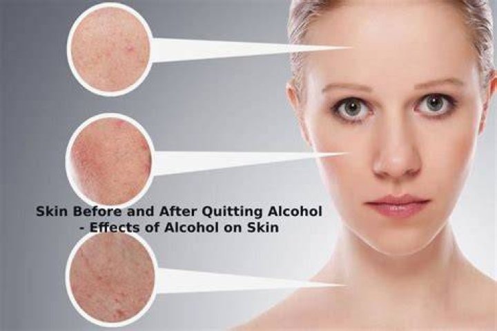 Can isopropyl alcohol be absorbed through the skin?