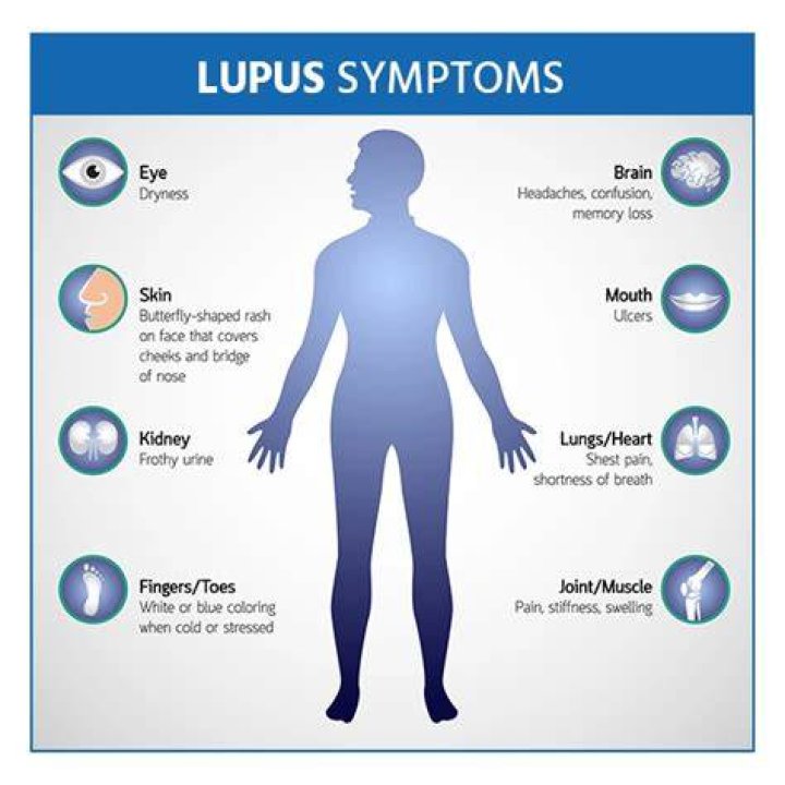 Can lupus be passed down from parents?
