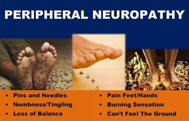 Can lying down cause neuropathy?