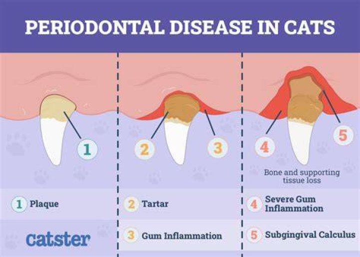Can periodontitis be misdiagnosed?