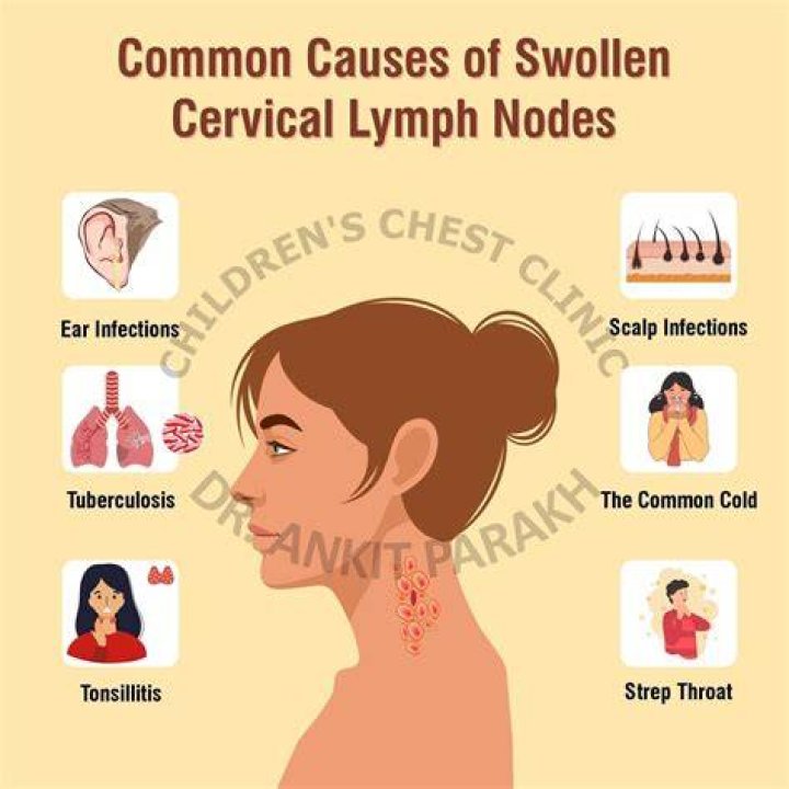 Can sinus problems cause swollen lymph nodes?