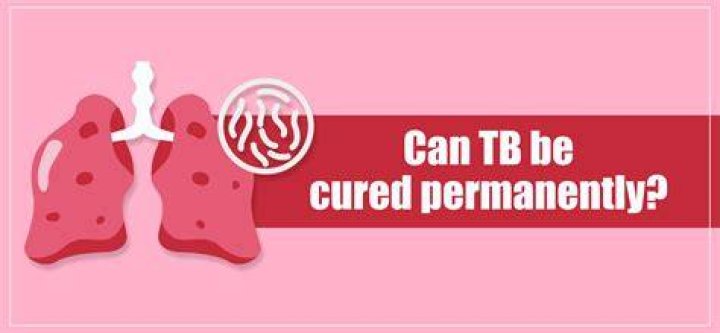 Can TB be cured permanently?