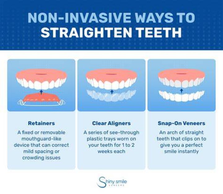 Can teeth naturally straighten?