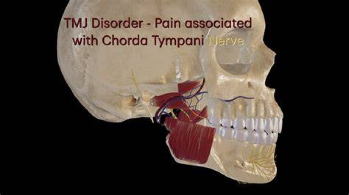 Can TMJ cause nerve damage?