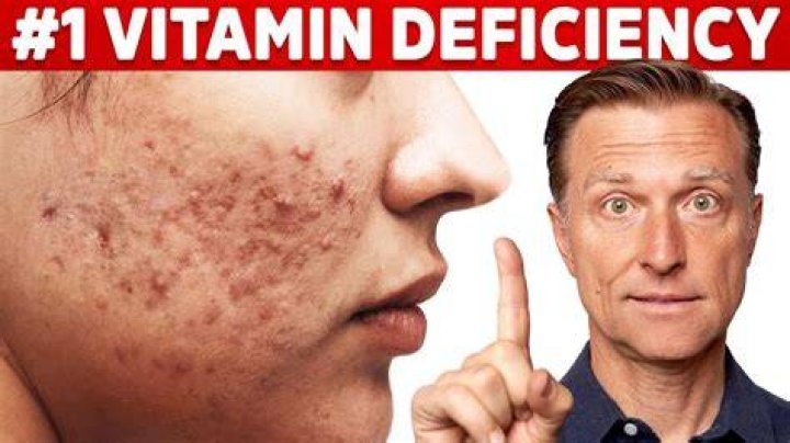 Can vitamin D deficiency cause skin problems?