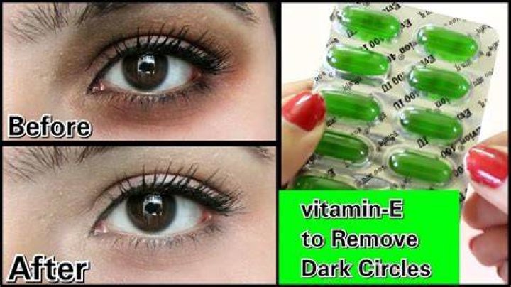Can vitamin E remove dark lips?