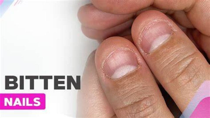 Can you bite your nails with dentures?