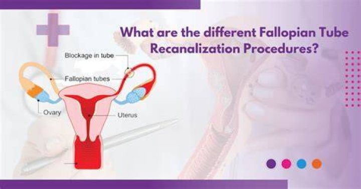 Can you feel your tubes growing back together?