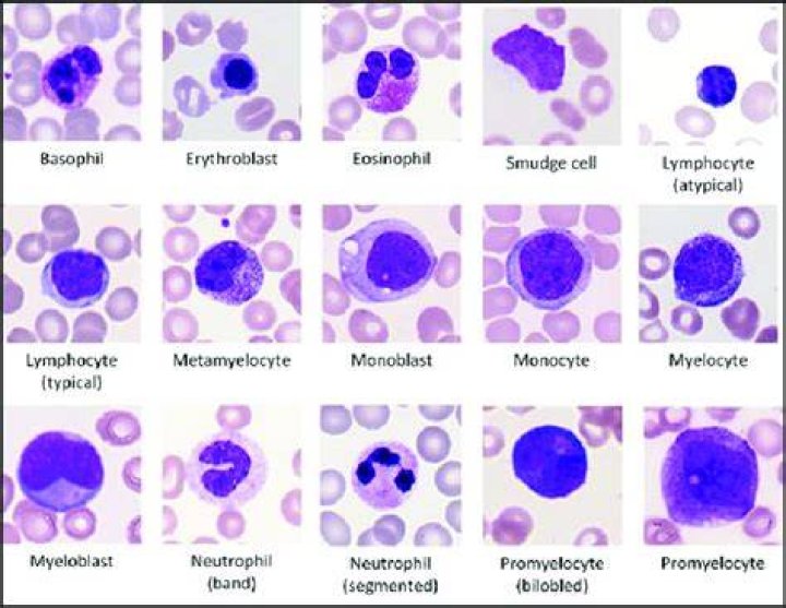 Can you get abnormal cells twice?
