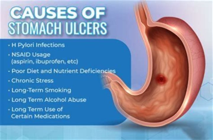 Can you get stomach ulcers from not eating?