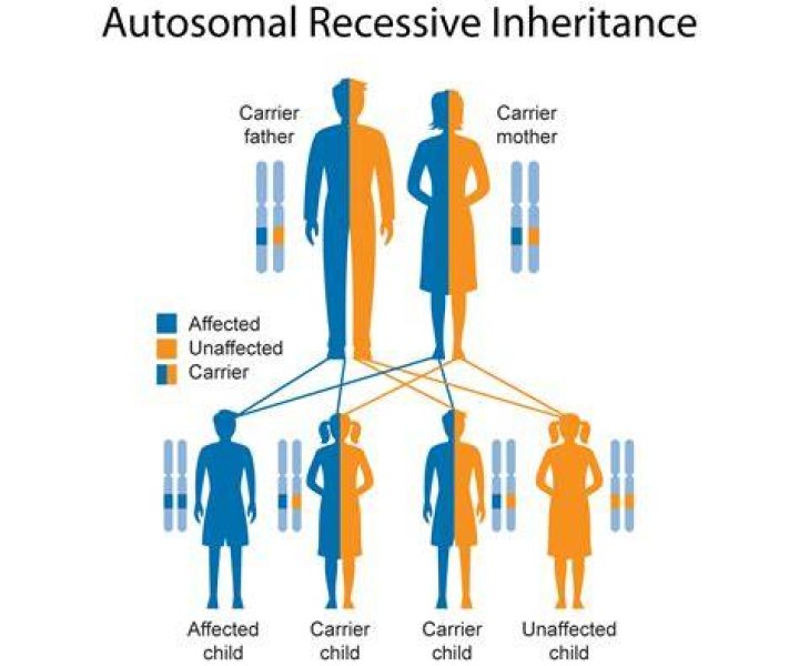 Can you inherit OCD from a parent?