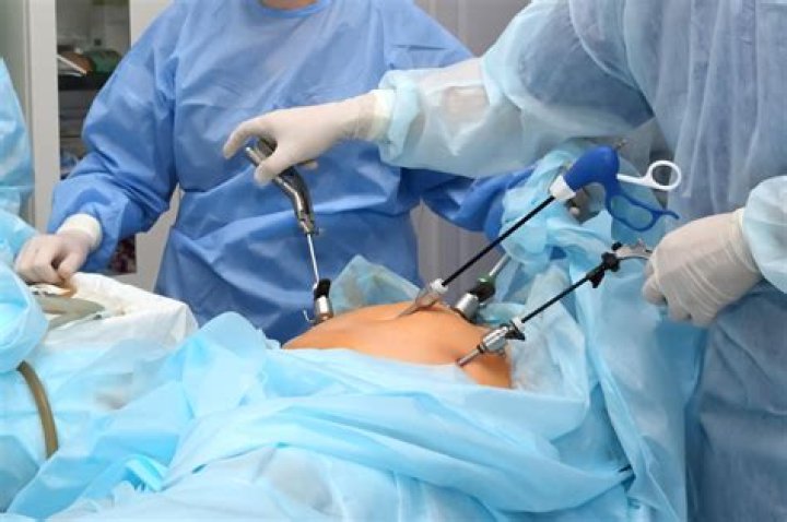 Can you lay on your side after laparoscopic surgery?