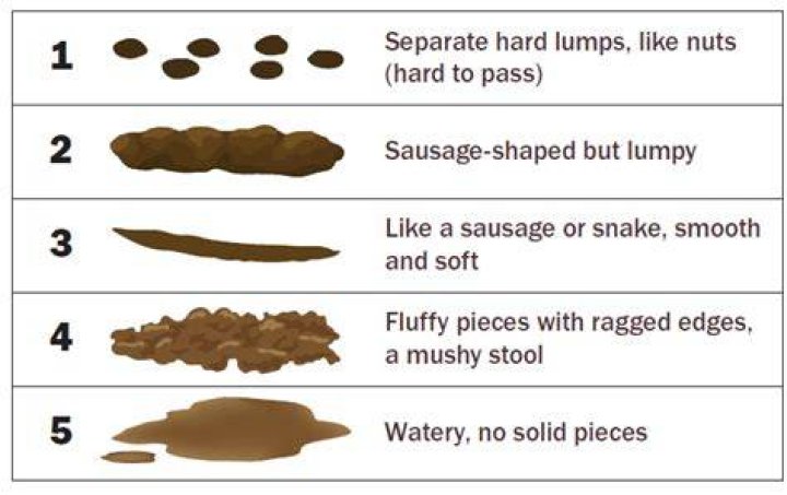 Can you poop while your sleeping?