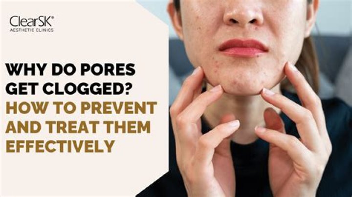 Can you pull out a pore?