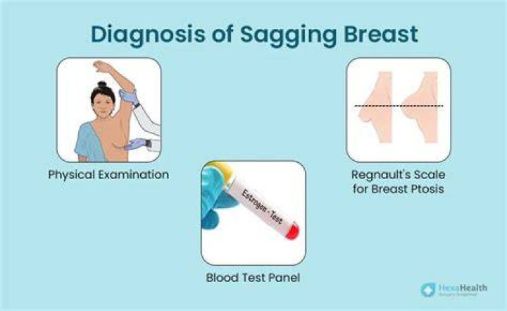 Can you tone saggy breasts?