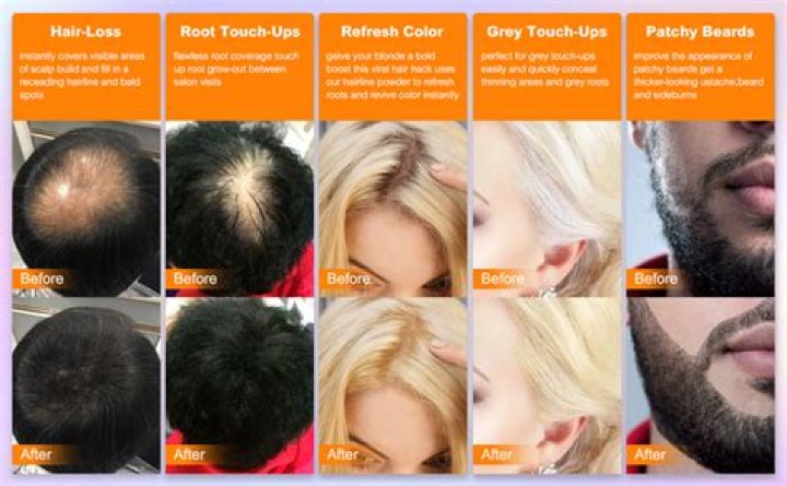 Can you use root cover up for bald spots?