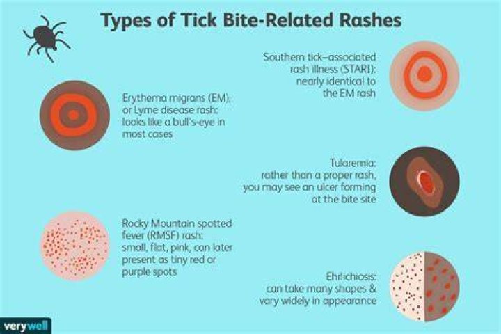 Do all tick bites leave a mark?