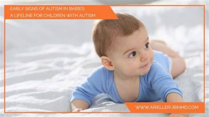 Do autism babies watch TV?