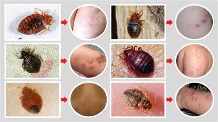 Do bedbugs bite?