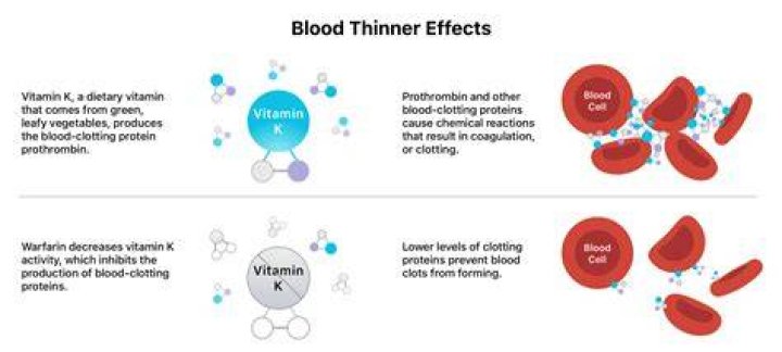 Do blood thinners affect the brain?