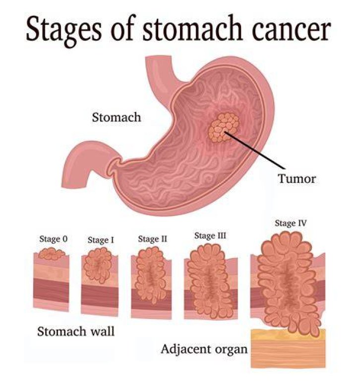 Do Cancers go back to their ex?
