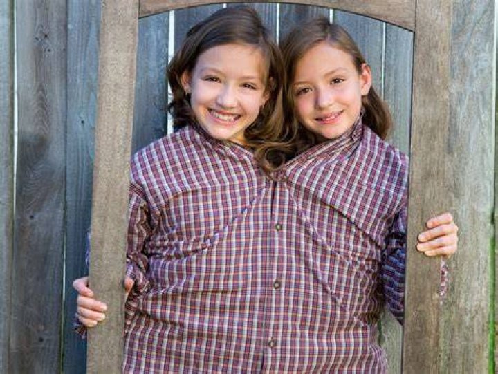Do conjoined twins share thoughts?